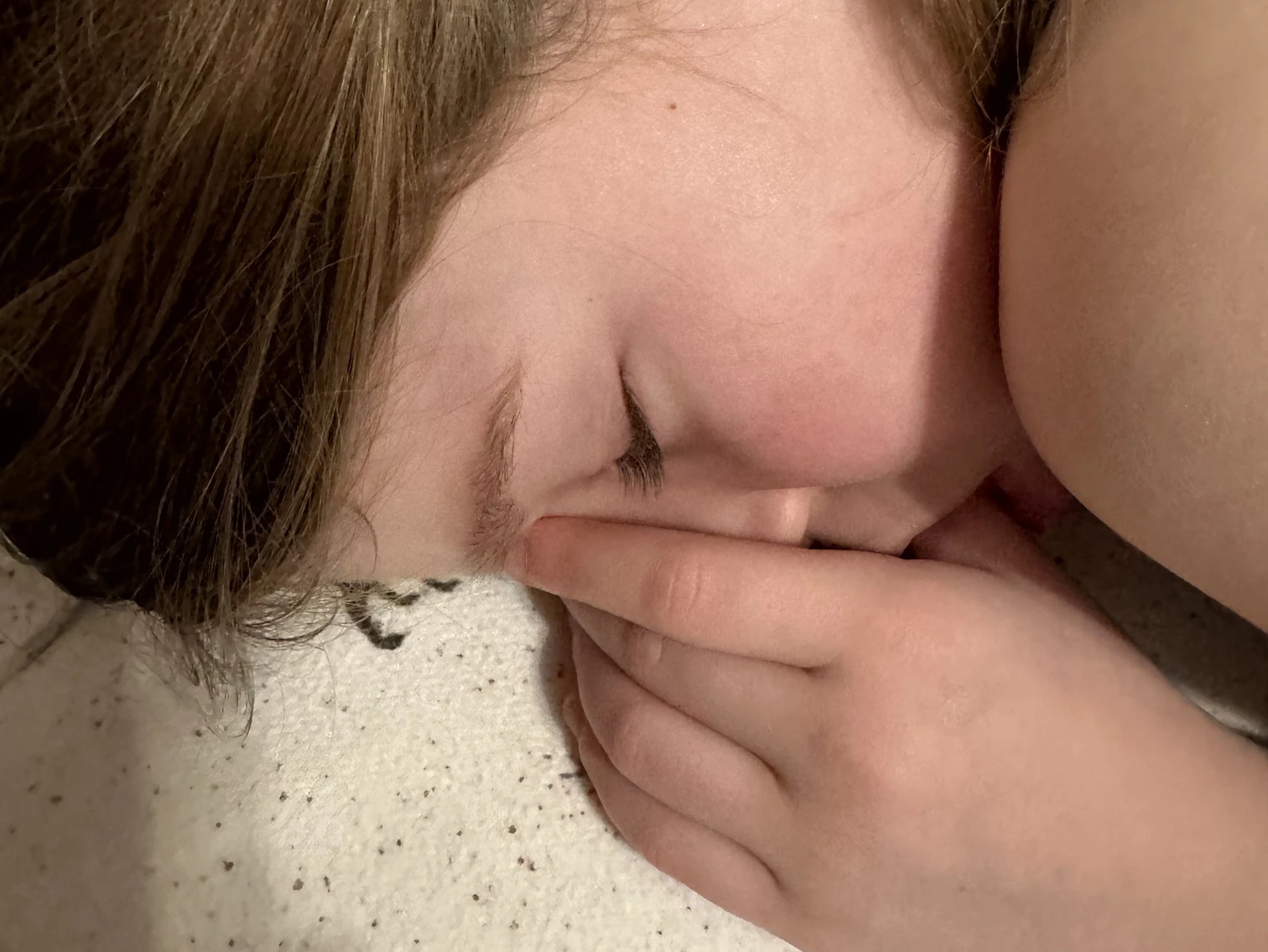 Frenectomy for Children